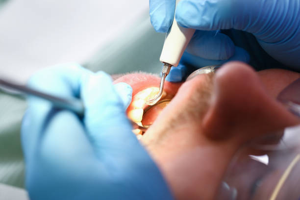 Trusted SC Emergency Dental Service Experts