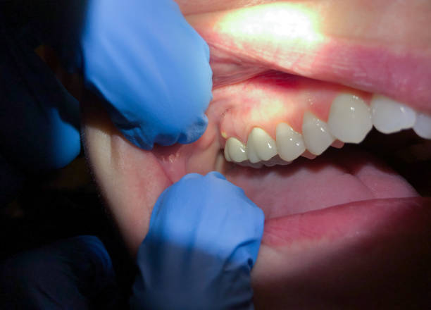 Best Emergency Dental Care for Sports Injuries in Hampton, SC