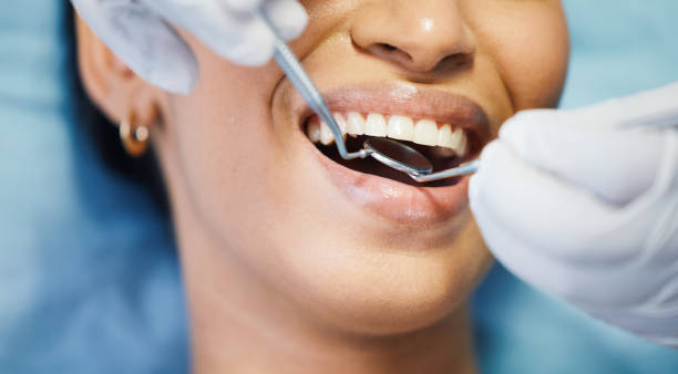 Best Emergency Treatment for Oral Infections in Hampton, SC